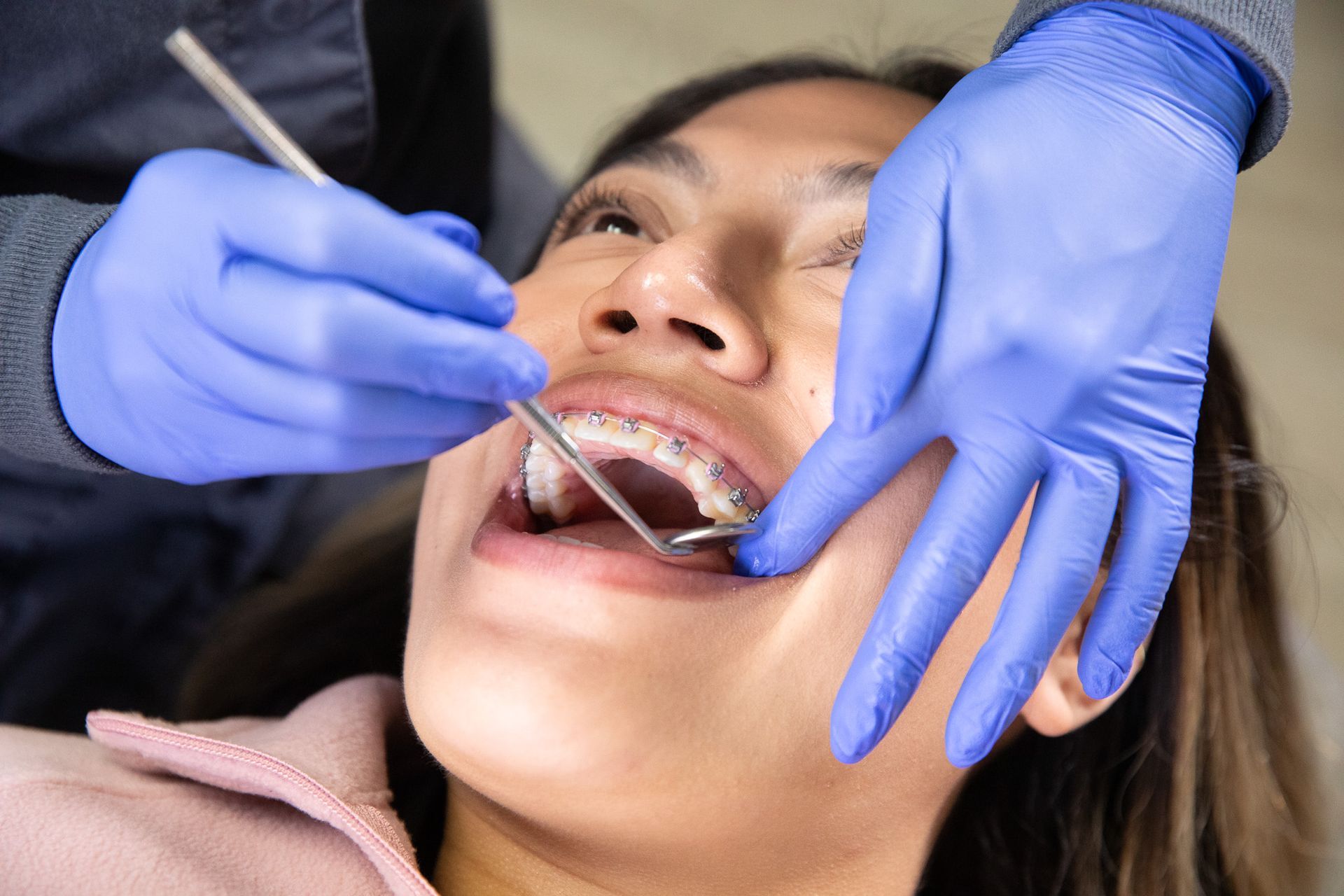 Dentist examining patient's teeth with braces, using tools and wearing blue gloves.