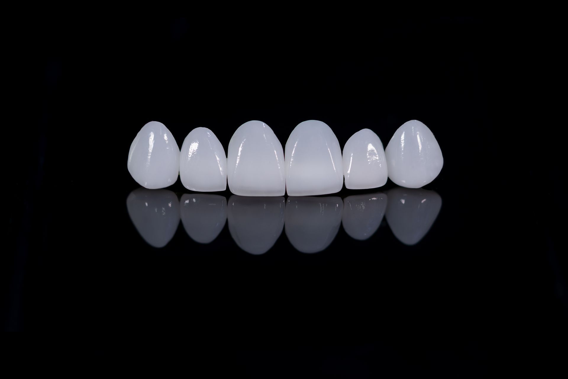 Six porcelain dental veneers on a reflective black surface.