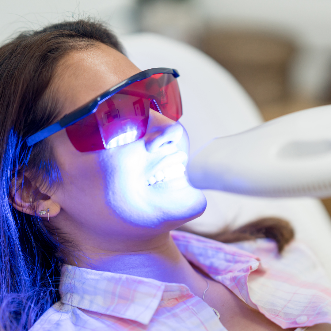 Your Guide to the Zoom Teeth Whitening Process