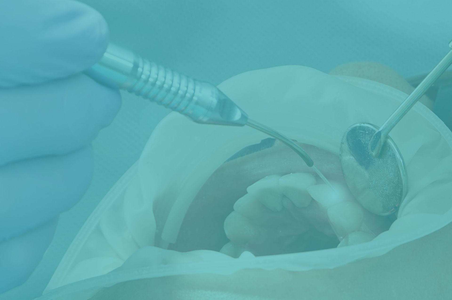 Laser dentistry