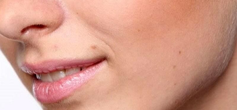 CIMOH Centro Médico Odontológico de Hidalgo Dr. Vargas Maxilofacial