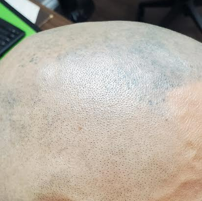 A close up of a bald head with a keyboard in the background.