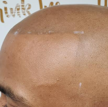 A close up of a bald man 's head with a shaved head.