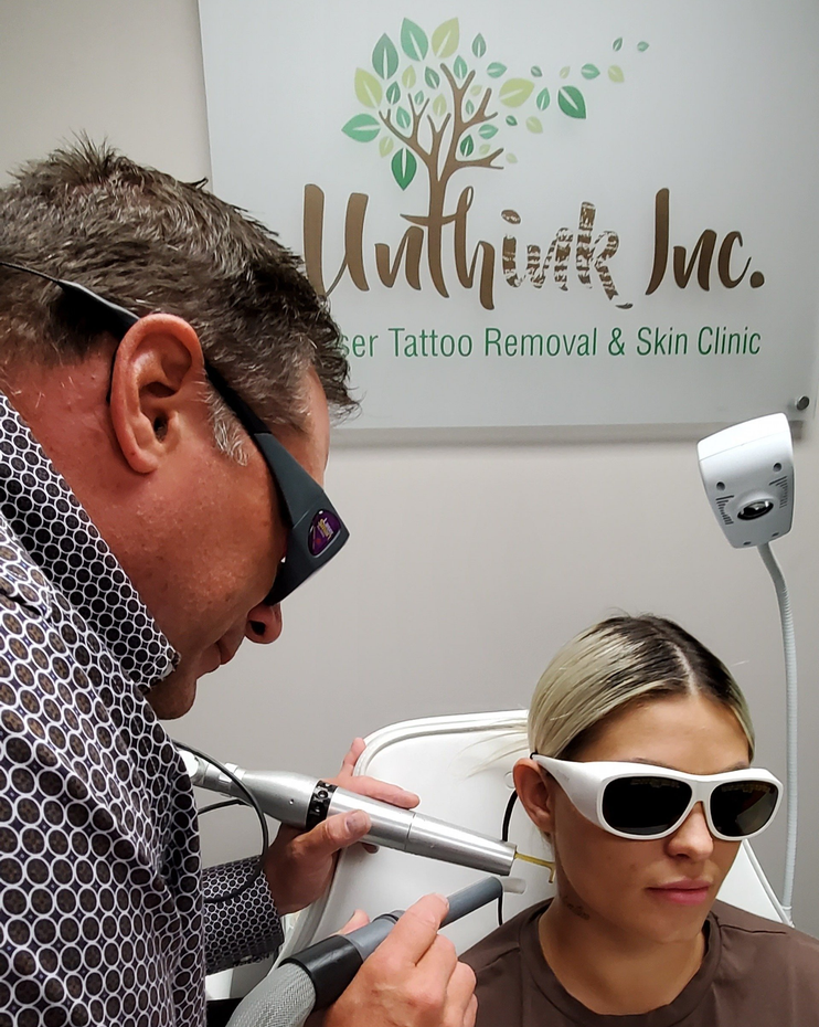 woman getting tattoo removed by laser