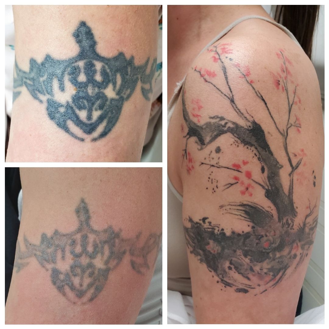 Unthink Inc Before and After Gallery