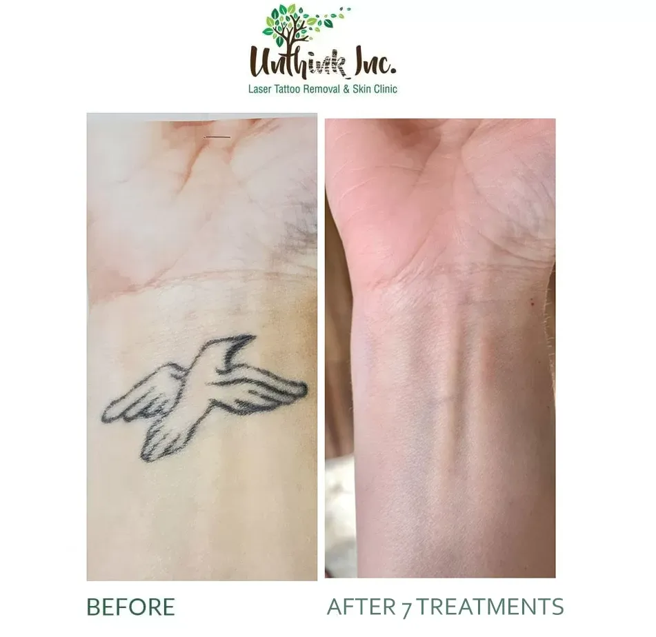 Unthink Inc before and after gallery