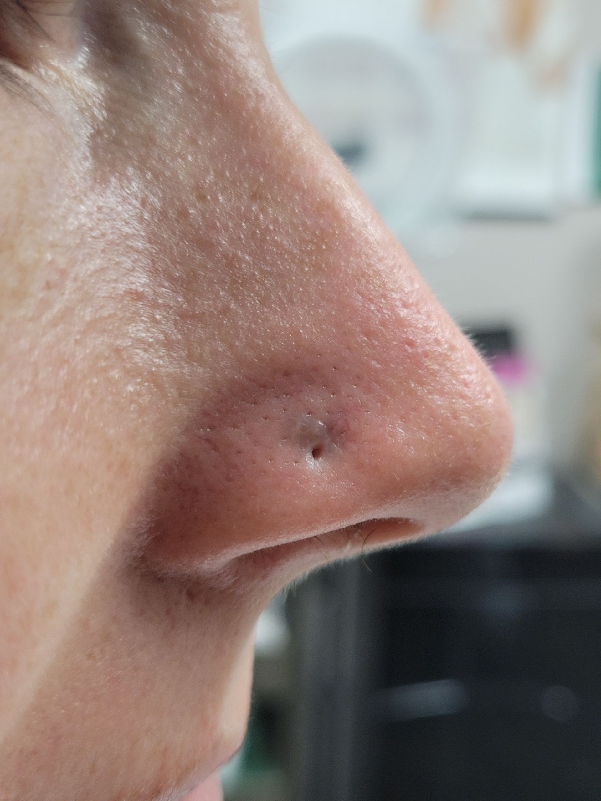 Close-up of a nose in profile; a small dark spot is visible on the tip. Skin is light-toned.