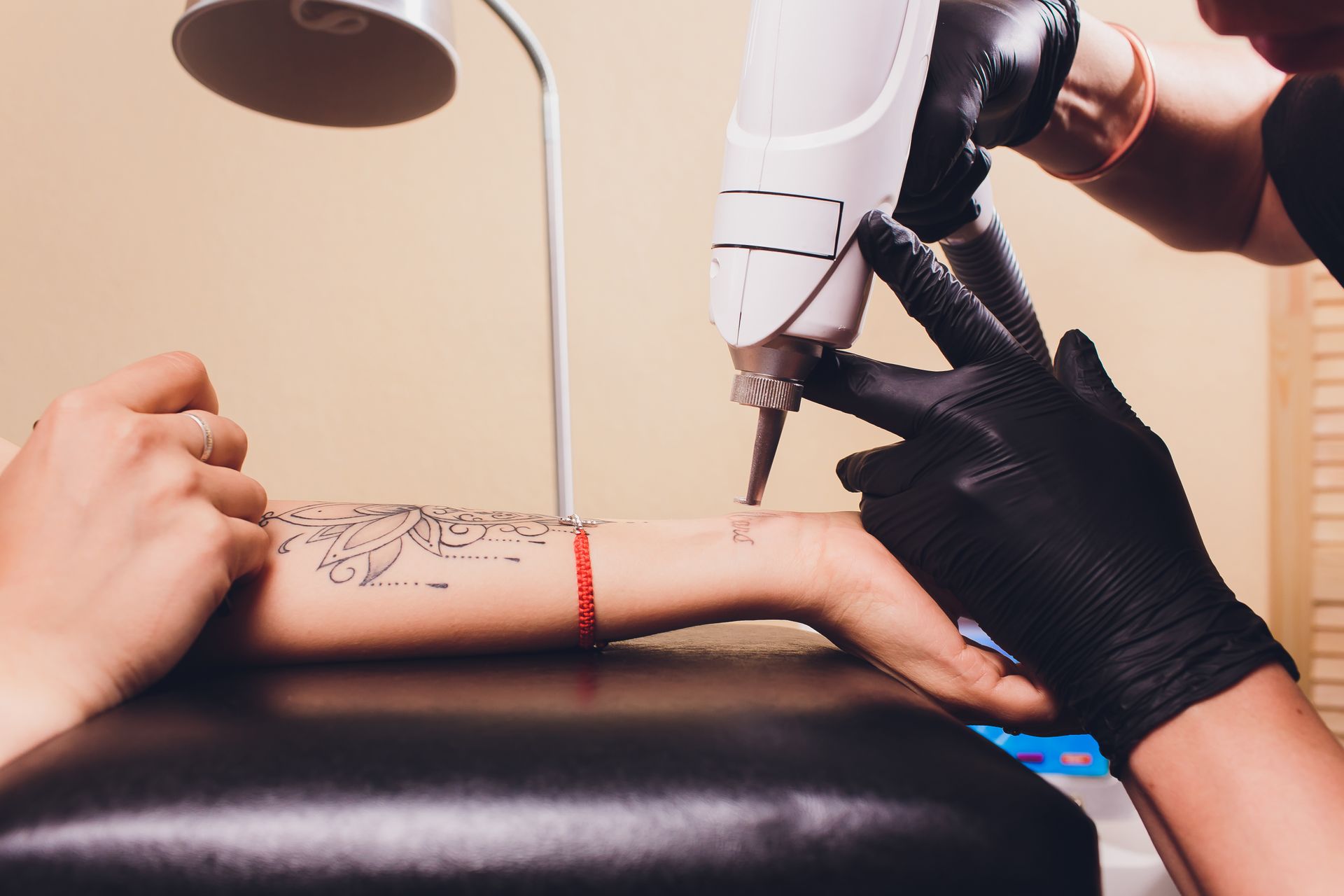 A person is getting a tattoo removed from their arm.