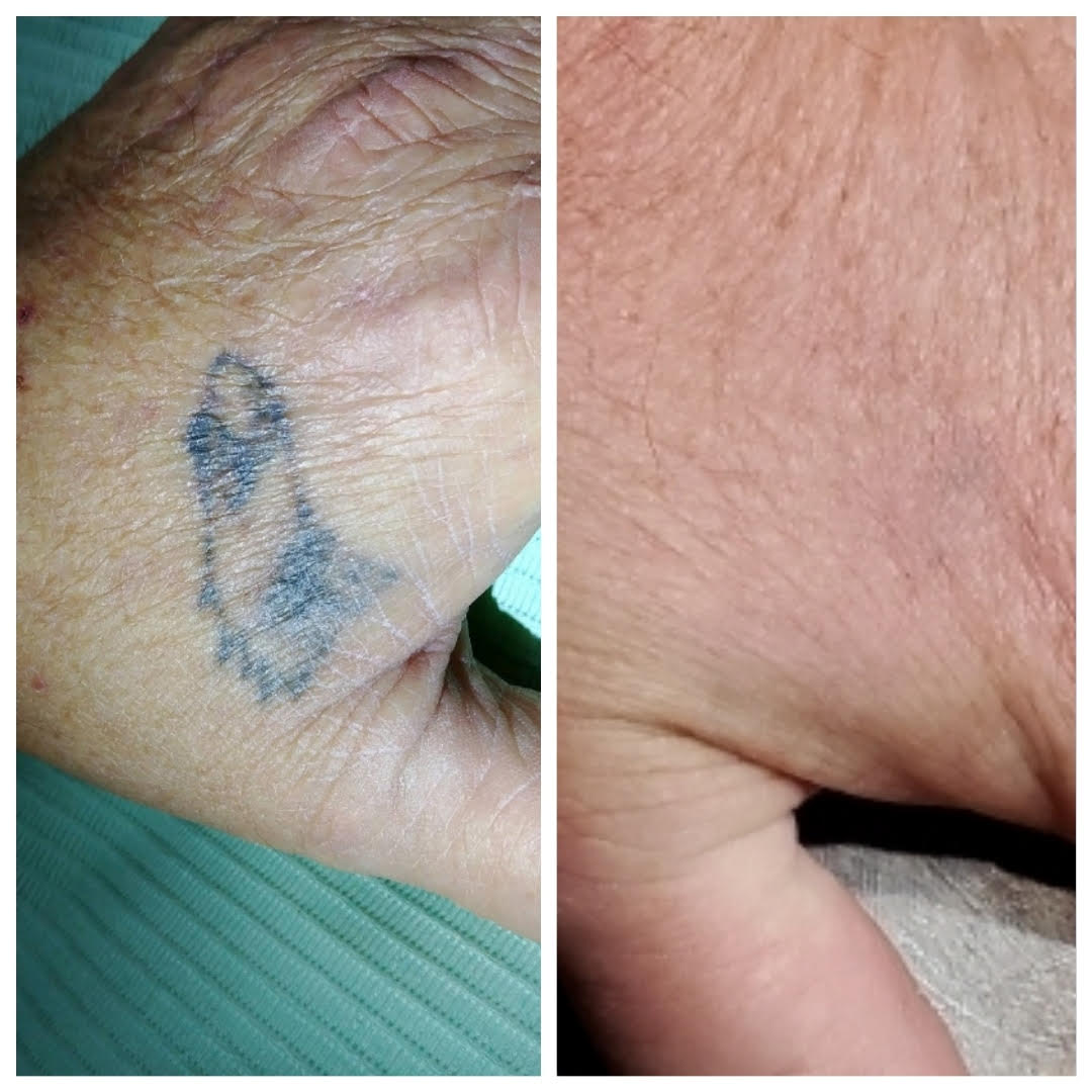 A before and after picture of a tattoo on a person 's wrist.
