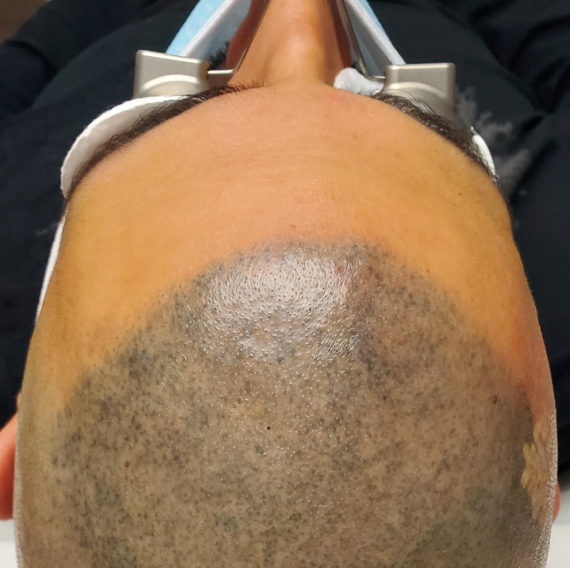 A close up of a man 's head with a shaved head