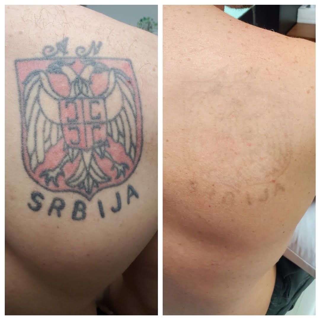 A man has a tattoo on his back that says srbija