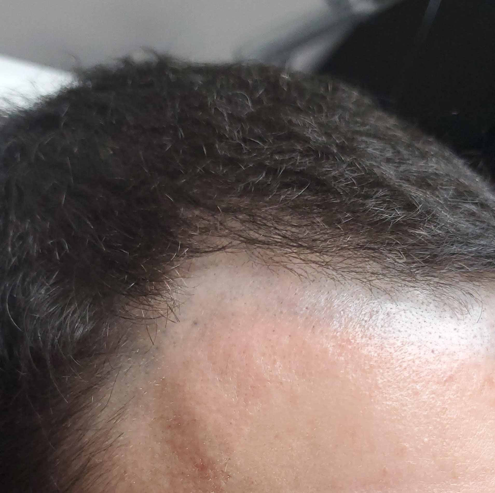 A close up of a man 's head with a shaved head.