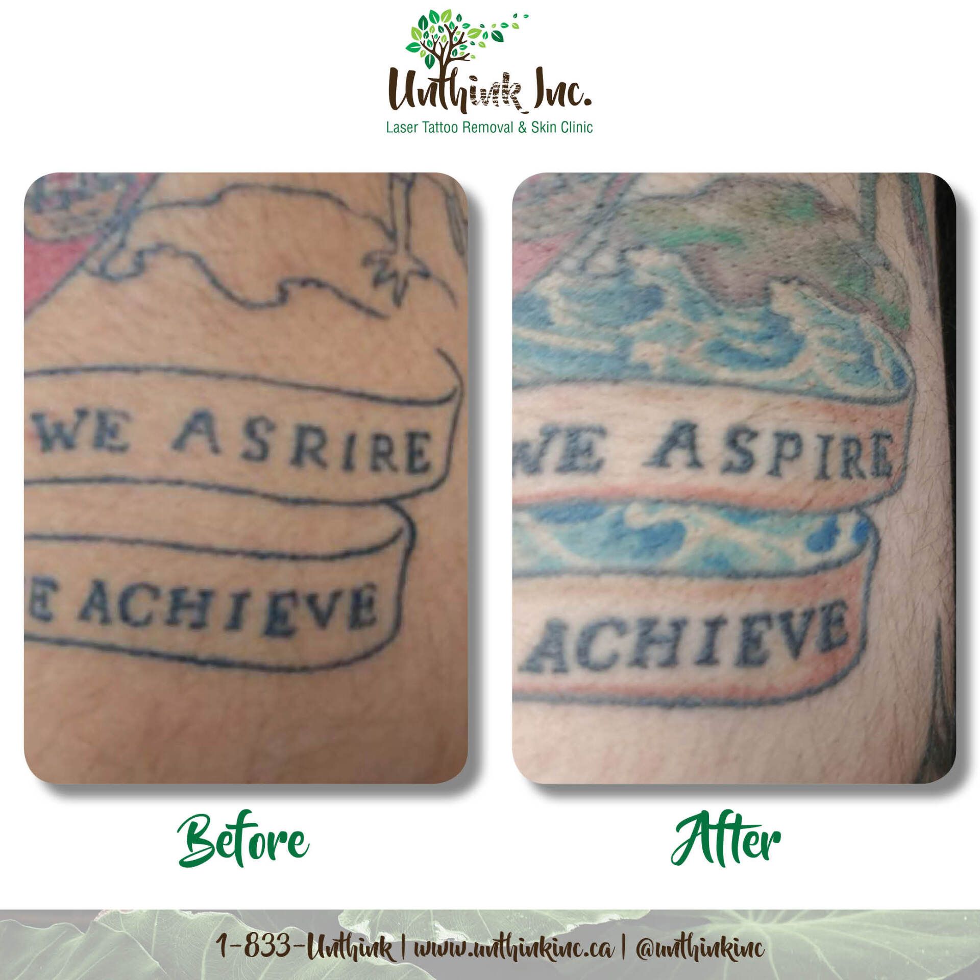 Unthink Inc Before and After Gallery