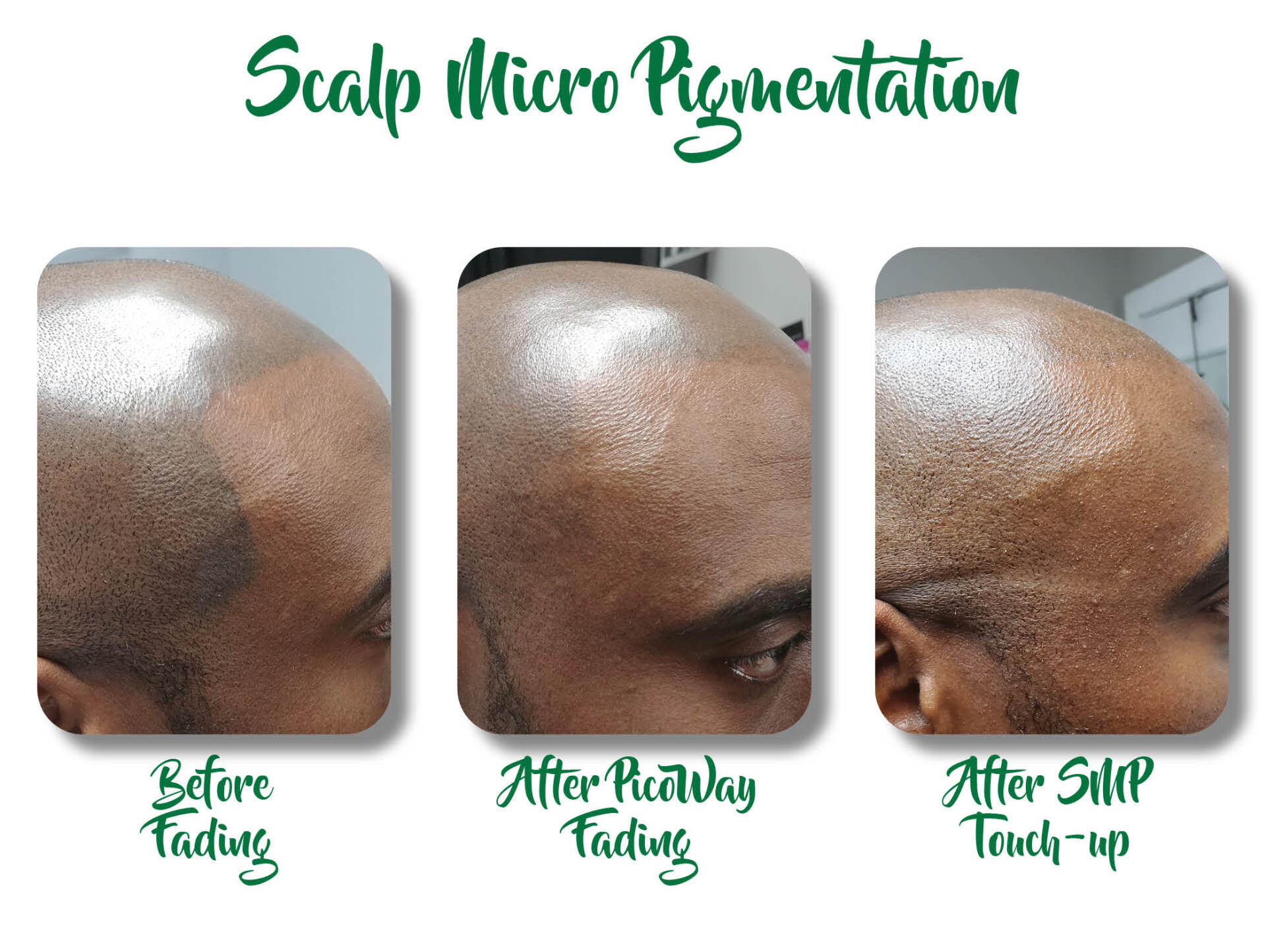 Unthink Inc Before and After Gallery