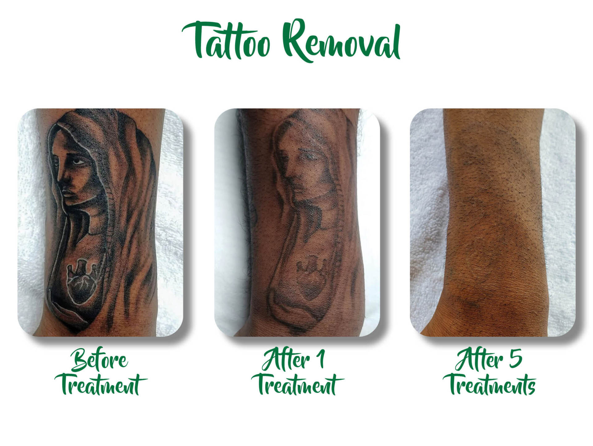 Unthink Inc Before and After Gallery