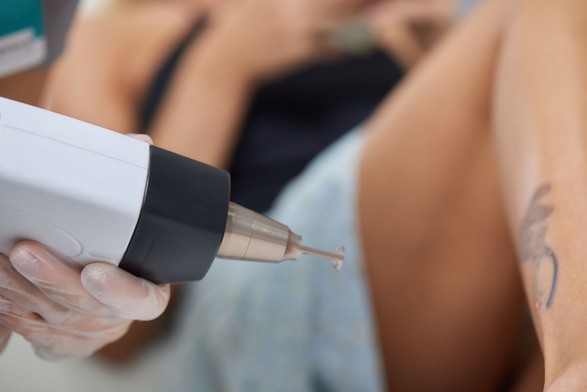 A person is getting a tattoo removed from their arm with a machine.