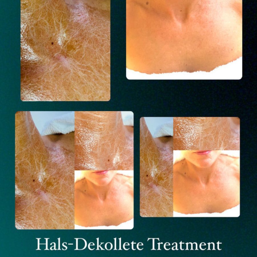 Eine Nahaufnahme des Gesichts einer Frau vor unscharfem Hintergrund.