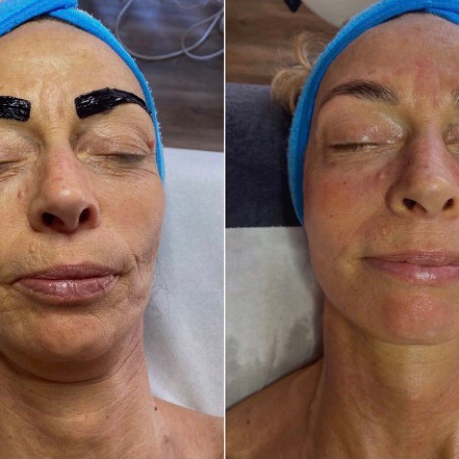 Eine Nahaufnahme des Gesichts einer Frau vor unscharfem Hintergrund.