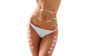 Trattamento adiposità