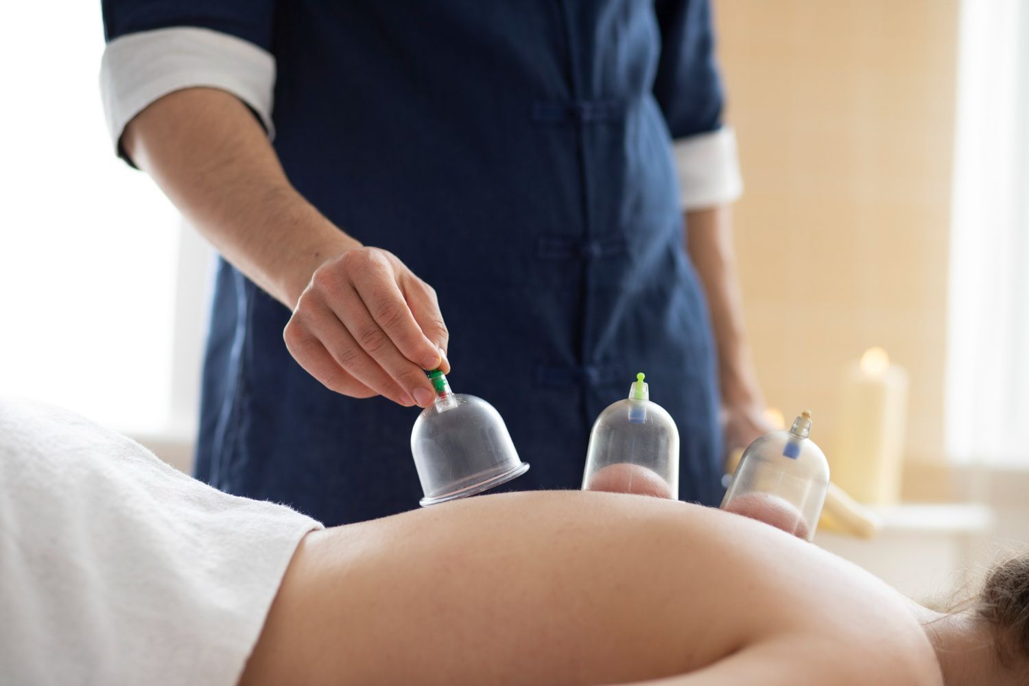 A woman is getting a cupping treatment on her back.