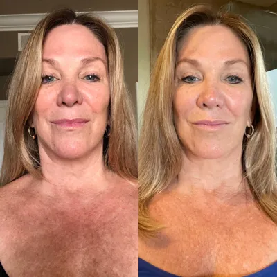 A before and after photo of a woman 's face