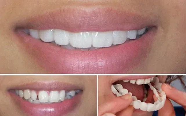 SNAP-ON SMILE