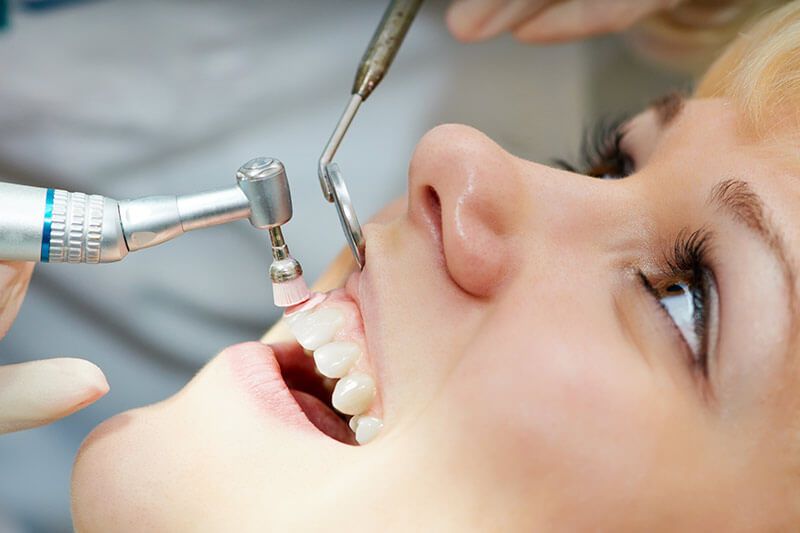PREVENTATIVE DENTISTRY | Woman getting teeth cleaned in Garland TX 75040