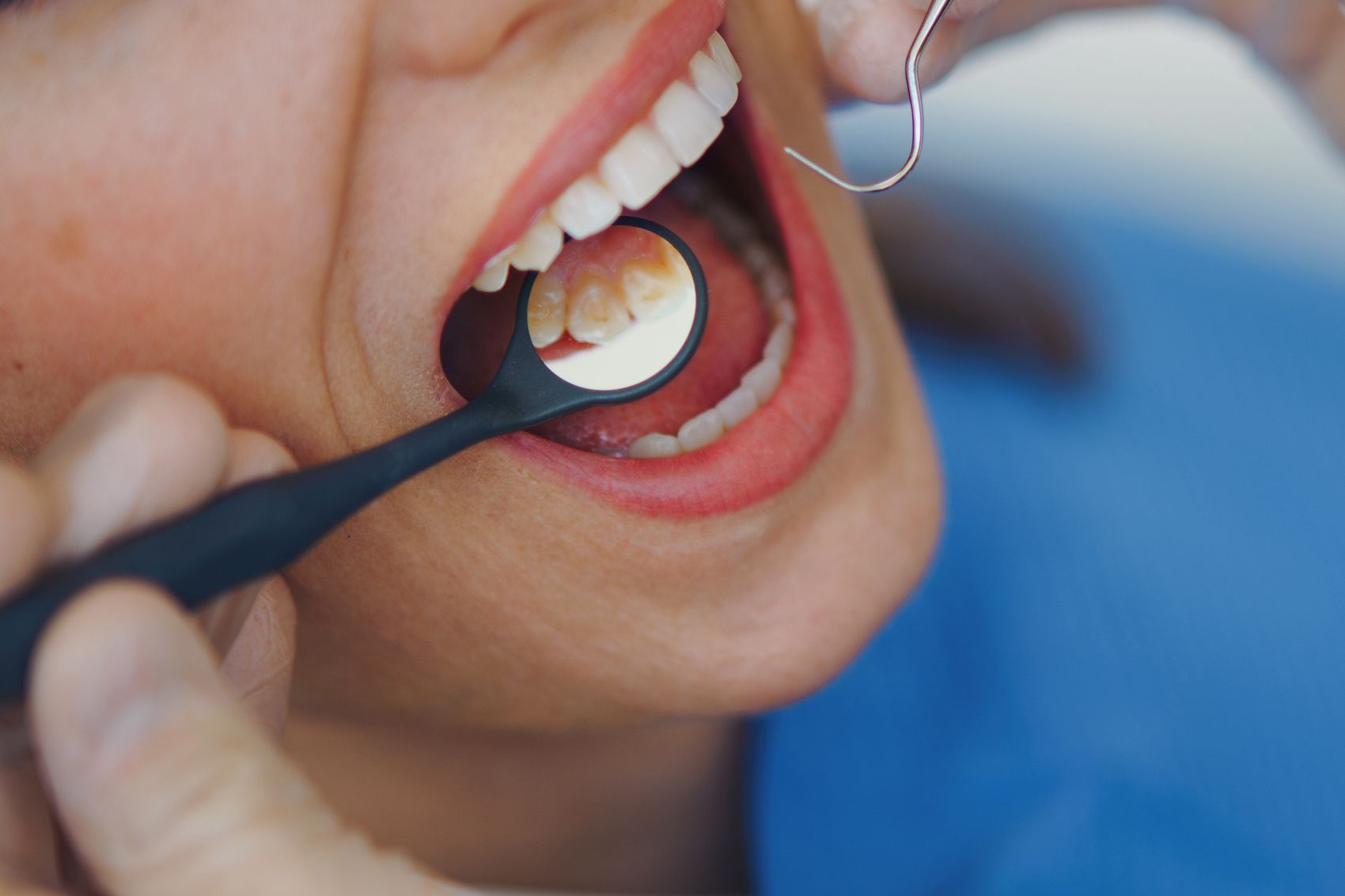 Dental Examination — Vineland, NJ — The Dental Wellness Center