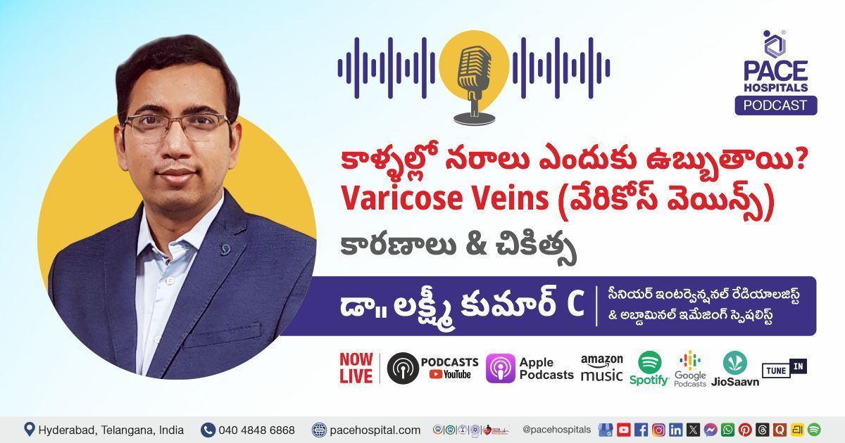 Varicose veins Telugu podcast by Dr. Lakshmi Kumar Chalamarla from PACE Hospitals