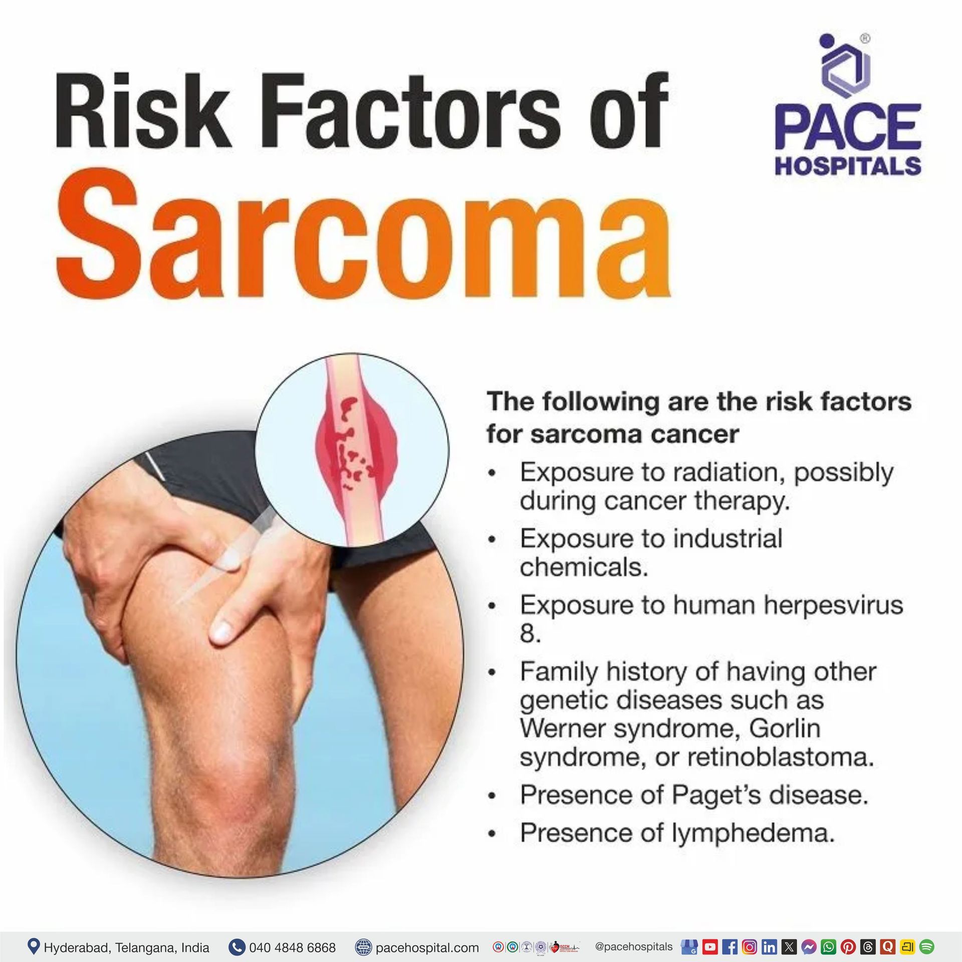 Sarcoma and Bone Cancer Awareness Month | Risk factors of Sarcoma | Sarcoma risk factors | Visual narrating the risk factors of sarcoma cancer