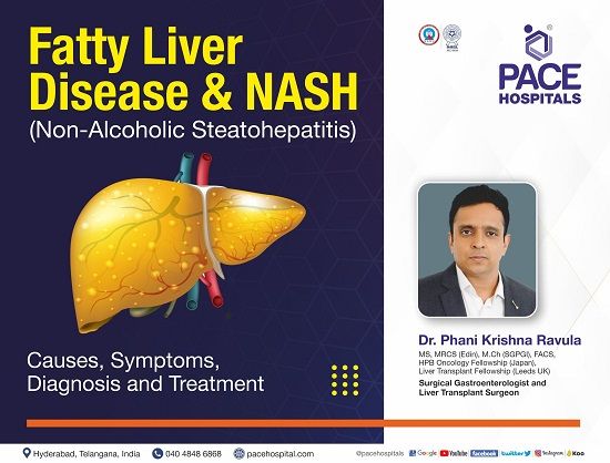 Fatty Liver Disease and NASH (Nonalcoholic steatohepatitis) | Dr Ravula Phani Krishna