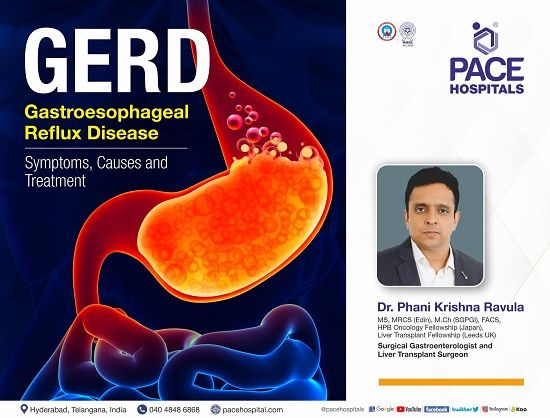 Gastroesophageal reflux disease (GERD) : Symptoms, Causes and Treatment | Dr Ravula Phani Krishna