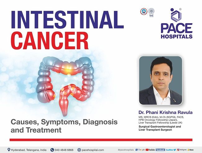 Intestinal Cancer, Large Bowel Cancer: Causes, Symptoms and Treatment | Dr Ravula Phani Krishna