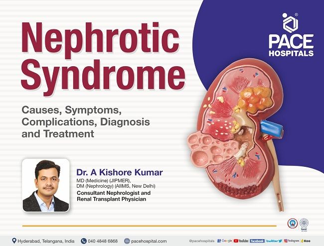 Nephrotic Syndrome - Causes, Symptoms, Complications, Diagnosis & Treatment | Dr A Kishore Kumar