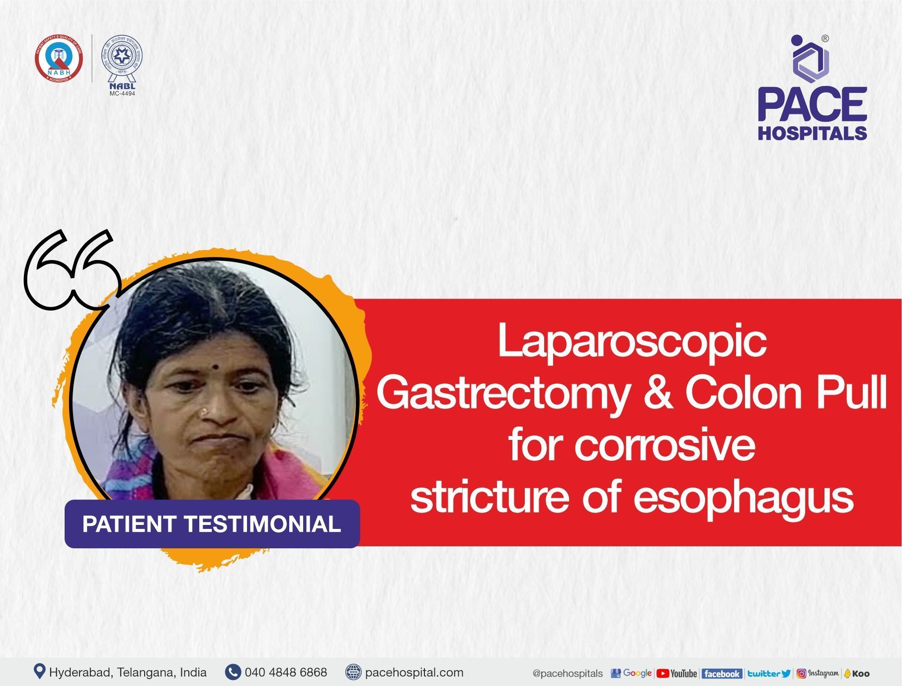 Laparoscopic Gastrectomy and Colon Pull for corrosive stricture of esophagus