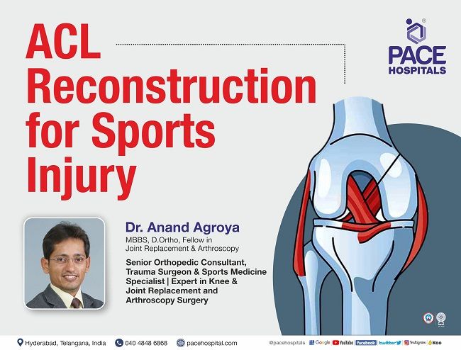 ACL reconstruction for Sports Injury | Dr Anand Agroya PACE Hospitals