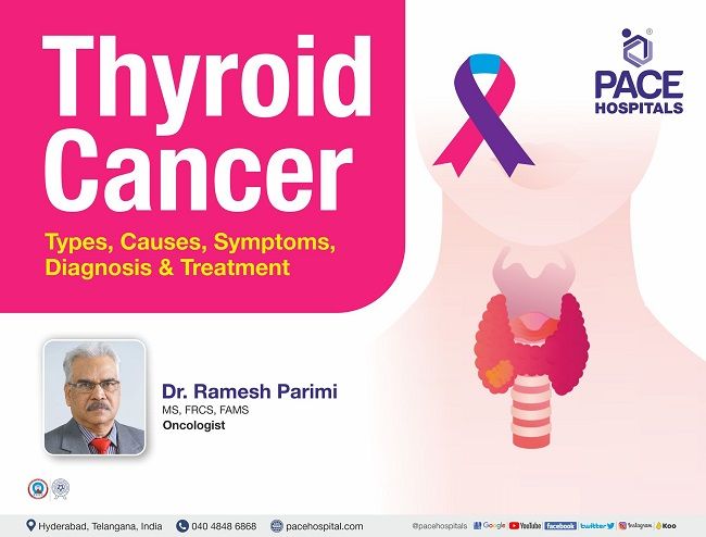 Thyroid Cancer - Types, Causes, Symptoms, Diagnosis & Treatment