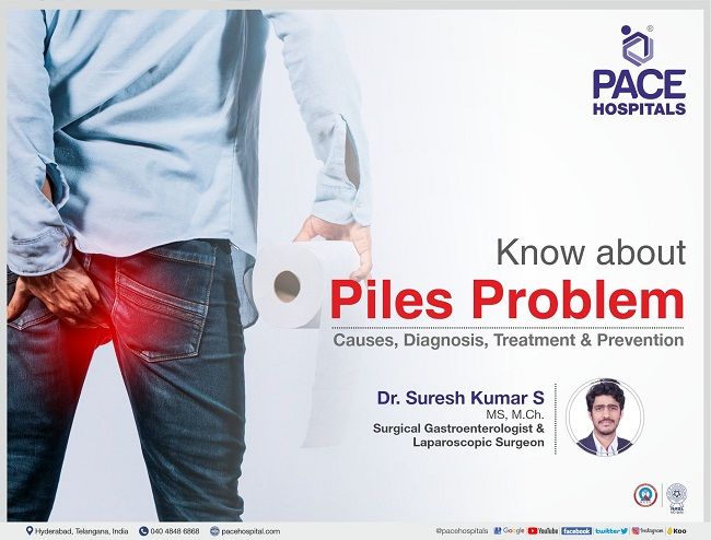 Piles Problem - Causes, Symptom, Diagnosis, Treatment and Prevention