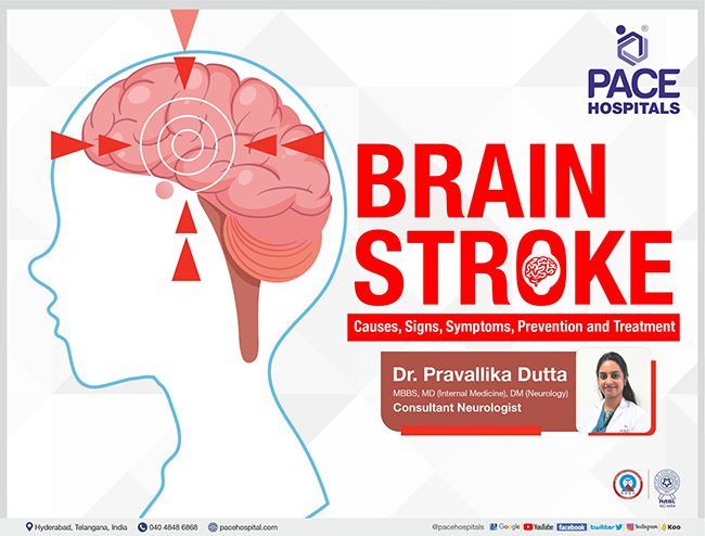 Brain Stroke - Causes, Signs, Symptoms, Prevention and Treatment | Dr Pravallika Dutta