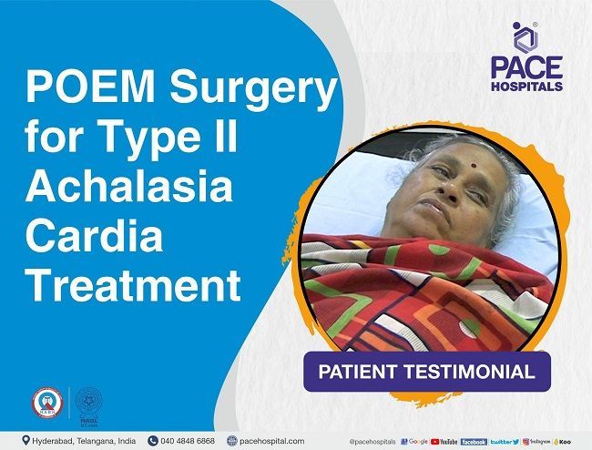 POEM Surgery for Type 2 Achalasia Cardia Treatment