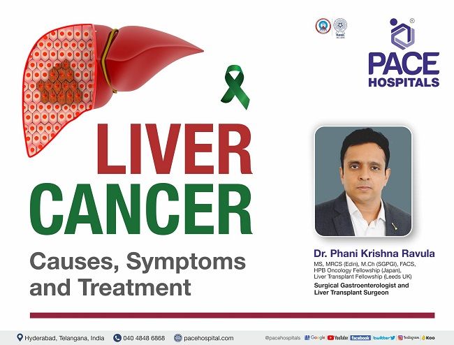 Liver Cancer: Causes, Symptoms, Risk, Diagnosis & Treatment | Dr Phani Krishna Ravula