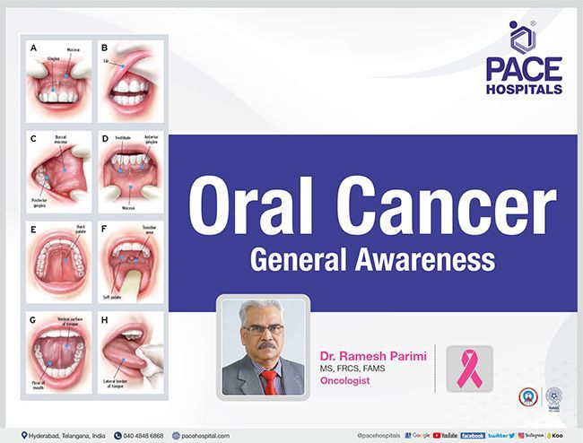 Oral Cancer - General Awareness (Prevention and Treatment) | Dr Ramesh Parimi