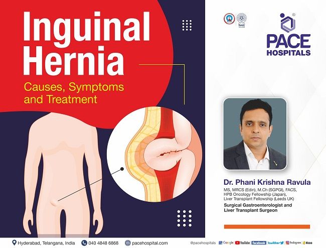 Inguinal Hernia (Groin Hernia) - Causes, Symptoms and Treatment | Dr Phani Krishna Ravula