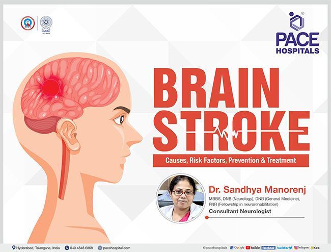 Brain Stroke - General Awareness (Causes, Risk Factors, Prevention & Treatment) | Dr Sandhya Manorenj