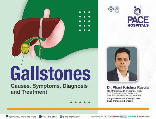 Gallstones (cholelithiasis) - Causes, Symptoms, Diagnosis and Treatment | Dr Ravula Phani Krishna