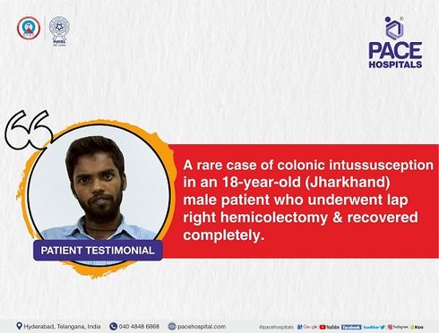 Patient Testimonial - Laparoscopic Right Hemicolectomy for Intussesption a rare Colonic Lipoma | best gastro hospital in hyderabad