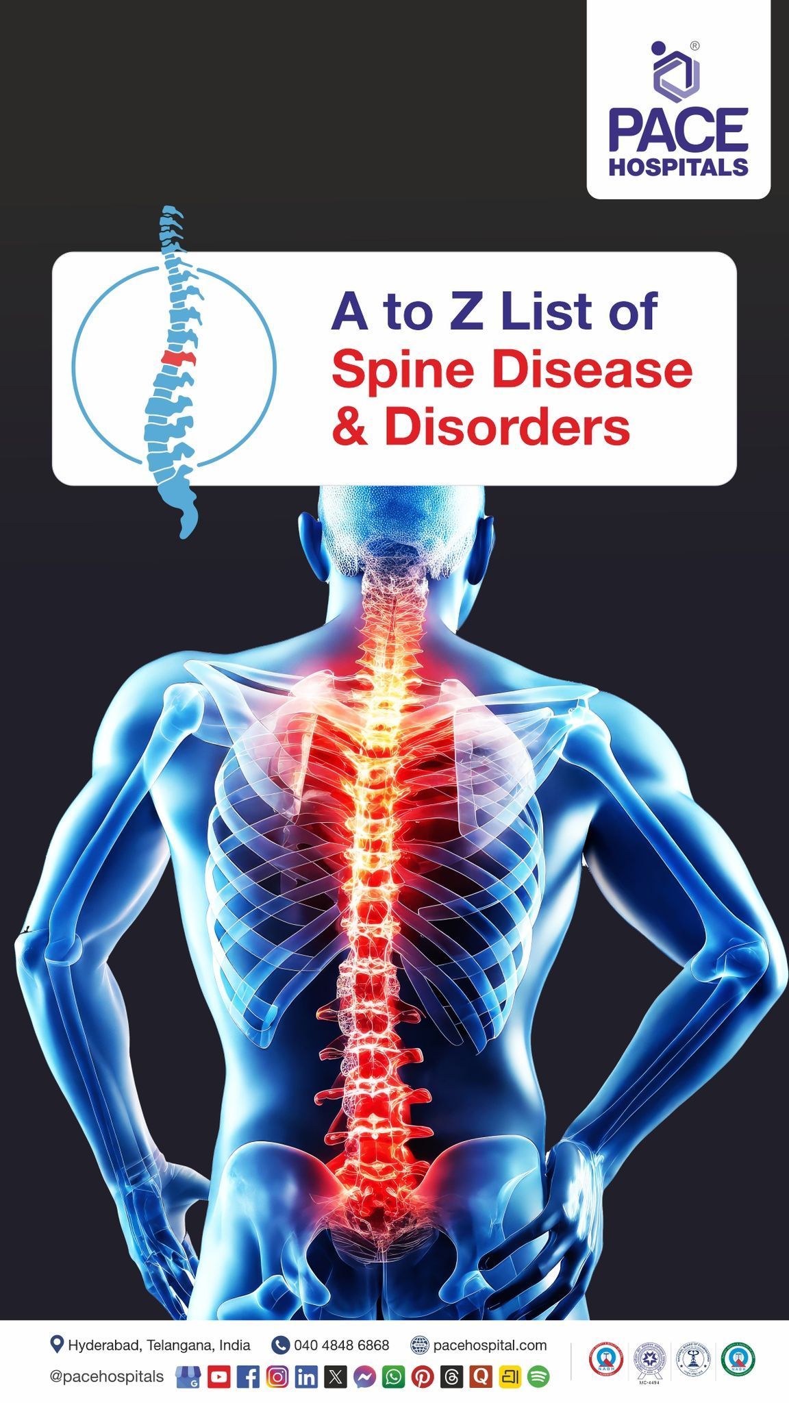 spine disorders list | spine related problems | spine disease names | list of spine disorders A to Z 
