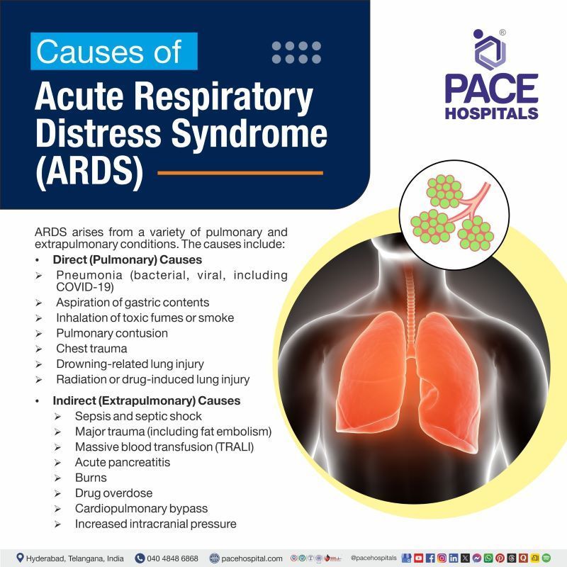 ARDS Causes | What causes ards | Acute respiratory distress syndrome causes