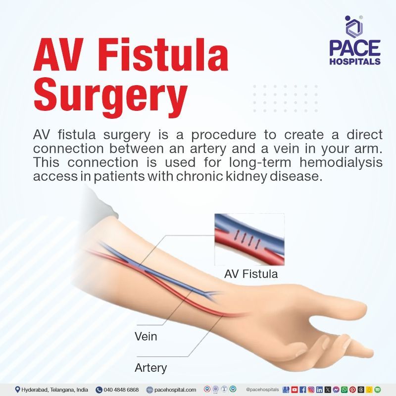 AV fistula surgery | AV fistula surgery for dialysis  | what is an AV fistula for dialysis | Visual explaining the meaning of  AV fistula surgery procedure