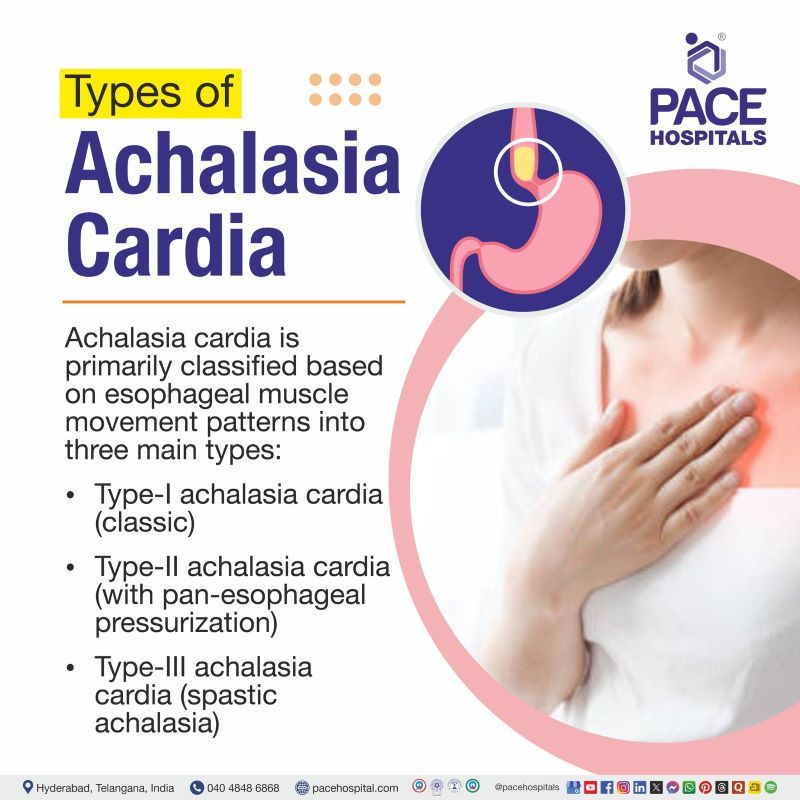 Achalasia Cardia Types Achalasia Cardia Types | Types of Achalasia Cardia